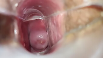 Amateur Woman'S Cervix Explored With Speculum